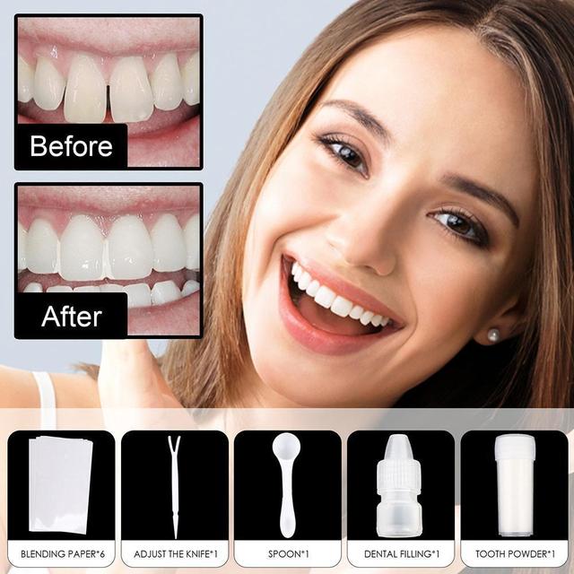 Shapeable Teeth Glue Set Party Makeup Temporary Filling Cavity Denture  Modification Tooth Filling U3H5